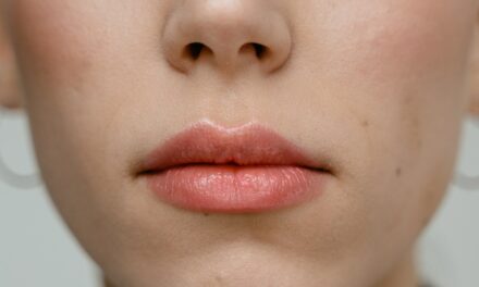 Beste Lippenbalsem: #1 Beste Koop, Kassa & Radar? Welke Kopen? [Top 10 Getest 2025]
